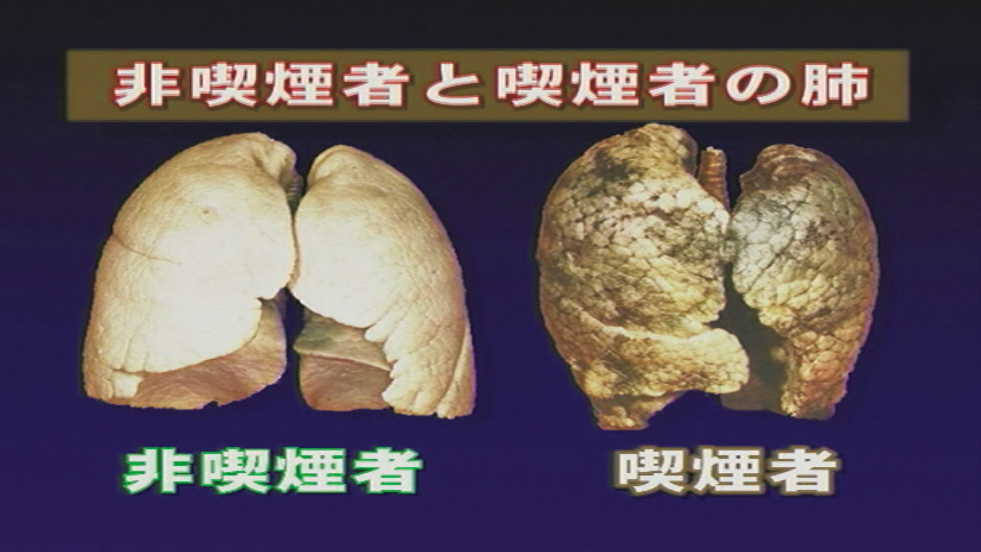 DVD 心と身体の健康シリーズ 第1巻 喫煙・飲酒・薬物乱用と健康