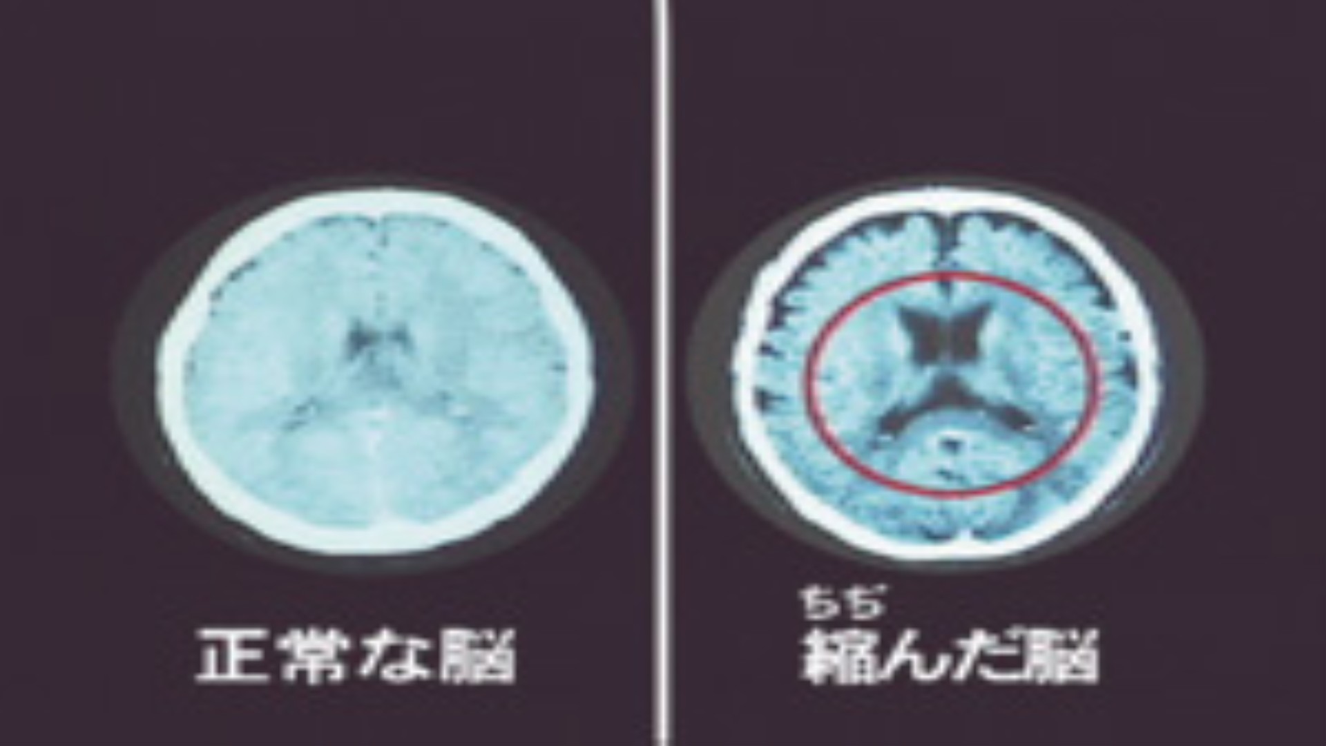 DVD 薬物乱用防止シリーズ 全2巻